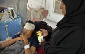 11% من إصابات حرب الإبادة هي إصابات في العيون بما يعادل 17 ألف إصابة