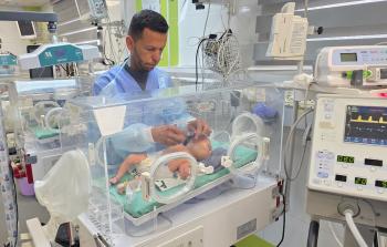 الرضيعة الغزية دعاء قشطة  داخل غرفة عناية في مستشفى ناصر جنوبي قطاع غزة