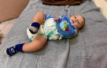الطفل الرضيع عمر أبو يوسف، لا تزال عائلته تنتنظر فتح معبر رفح للسفر وعلاجه في الخارج وسط تدهور وضعه الصحي