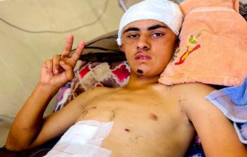 اللاعب الشاب محمد نعيم عوض، أصيب بشلل نصفي بفعل رصاصة إسرائيلية