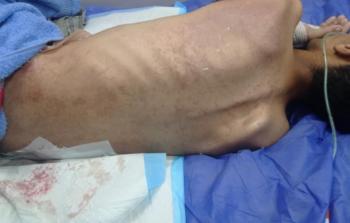 الجريح الشاب نبيل أبو جبر (20 عامًا)