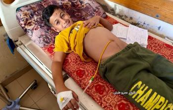 الطفل المصاب إبراهيم الشاعر