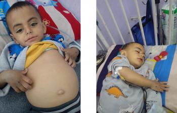 الطفل  نضال أبو ربيع، الذي لم يتجاوز عامه الثاني، يواجه أمراضًا قاسية بجسدٍ صغير