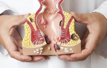 صورة توضيحية