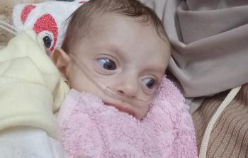 الطفلة الرضيعة ألما أبو ريدة