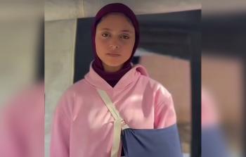 الطفلة إلهام زاهر يونس (14 عامًا) مع جرحٍ مفتوح منذ أكثر من عامين