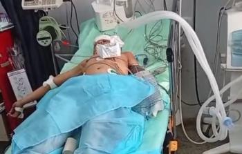 الطفل محمد خليل أبو سمعان داخل العناية المركزة في مجمع الشفاء الطبي