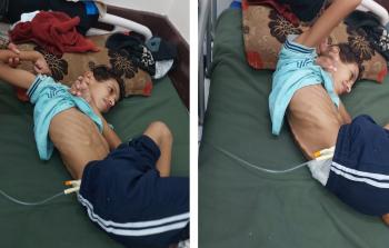 يوصف أصيب بشظية في الرأس في مكان بالغ الحساسية مما أفقده القدرة على الحركة