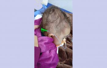 عشرات الأطفال فقدوا حياتهم بينما كانوا ينتظرون الإجلاء الطبي للعلاج خارج غزة