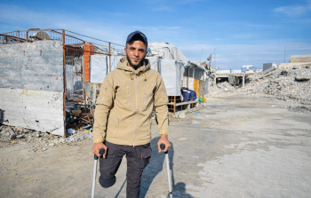 محمود النَّجَّار فقد ساقه وأهله في الحرب