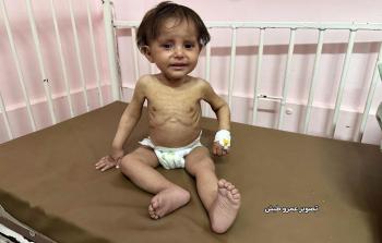 محمد زنون، البالغ من العمر عامًا ونصف العام، لم يعرف حياة طبيعية منذ ولادته