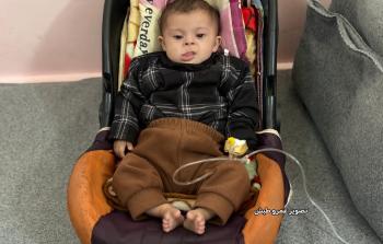 تعاني أمينة متلازمة داون، إضافة إلى عيب خلقي في القلب يتمثل في ثلاثة ثقوب