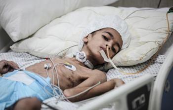 ريان.. طفولة معلّقة بين الألم والأمل