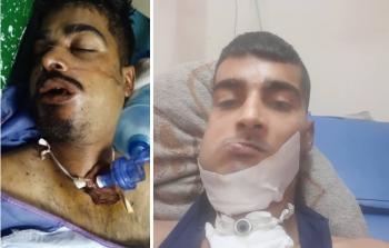 رصاصة متفجرة قطعت لسان معاذ الكحلوت، وكسرت فكيه