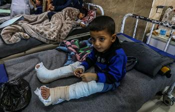أكثر من 21,510 أطفال أصيبوا خلال حرب الإبادة على غزة