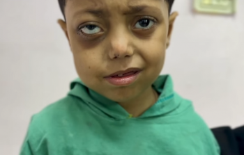 الطفل خالد عاشور
