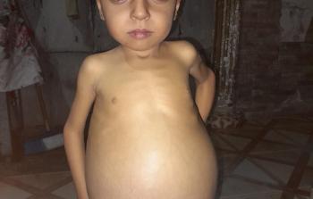 الطفل محمد مسلم