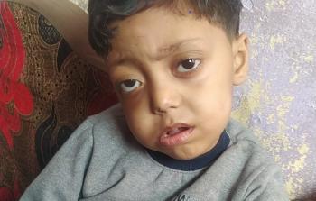 الطفل المريض بالسرطان خالد صالح