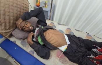 الشاب محمد أبو جاموس