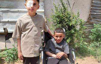 شظايا الاحتلال تسرق الطفولة والنطق من شقيقين وتتركهما بانتظار السفر للعلاج