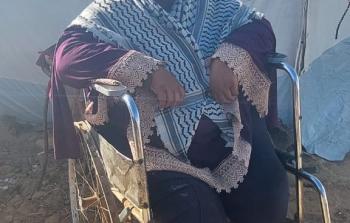 سميرة الشوربجي.. بترت الحرب قدمها وحاصرها نقص الغذاء والدواء