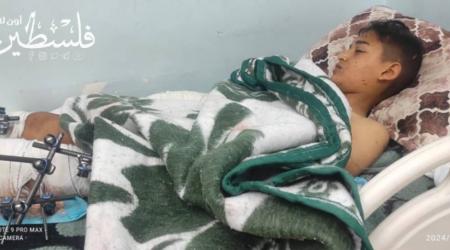 محمد أبو سمور.. طفل ضحية لـ"زجاجة عطر" مُلَغَّمة !