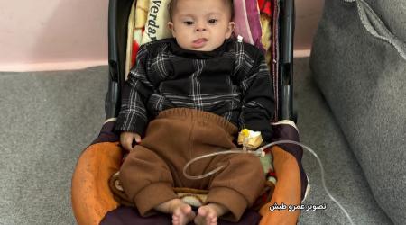 تعاني أمينة متلازمة داون، إضافة إلى عيب خلقي في القلب يتمثل في ثلاثة ثقوب