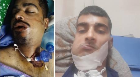 رصاصة متفجرة قطعت لسان معاذ الكحلوت، وكسرت فكيه