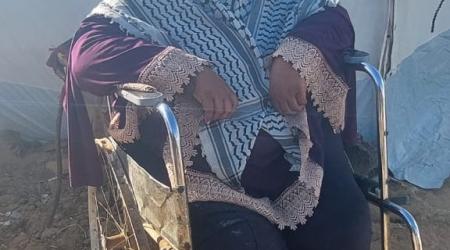 سميرة الشوربجي.. بترت الحرب قدمها وحاصرها نقص الغذاء والدواء