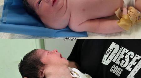 ناصر الخطيب.. رضيع يواجه مرضًا نادرًا في غزة