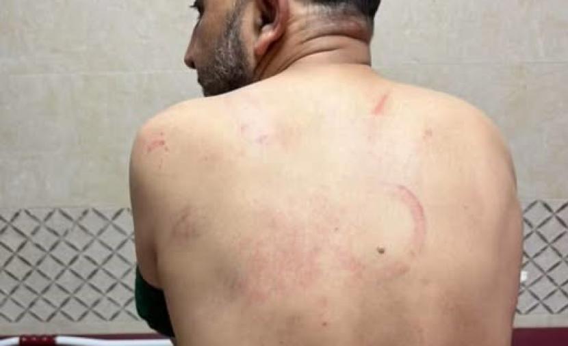ناشط فلسطيني يروي محاولة قتل بمركز أمني بجنين