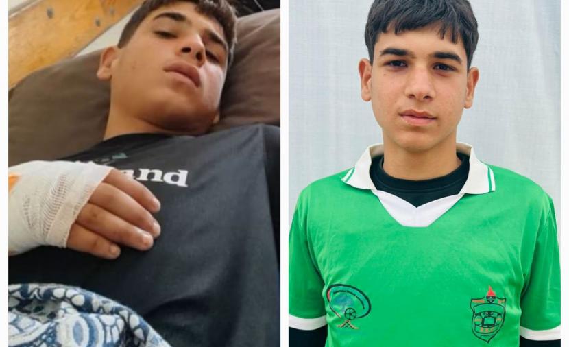غارة إسرائيلية تصيب لاعب كرة قدم برام بخان يونس