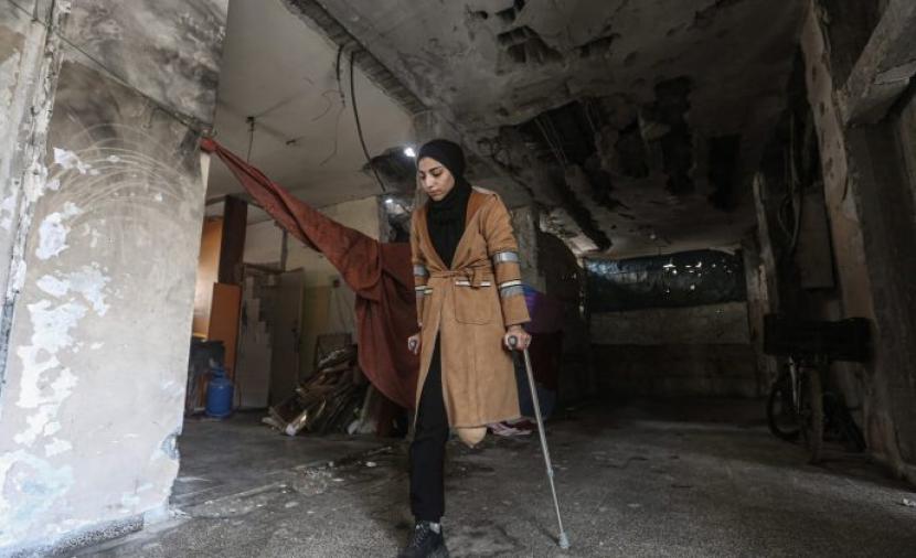 وزارة الصحة: العلاج الطبيعي شريان حياة لآلاف الجرحى بغزة