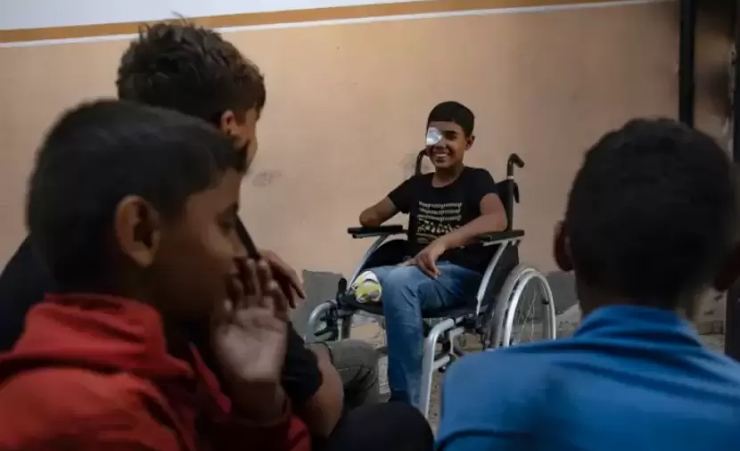 مبتورو الأطراف بغزة يحتاجون تأهيلاً ممتداً بعد الجراحة