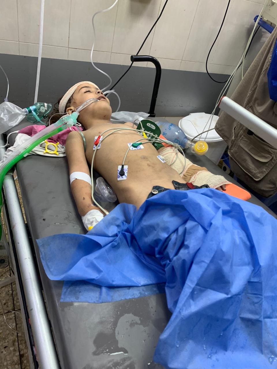 الطفلة ميرا تعاني أوضاعا نفسية سيئة في صراعها مع الشلل وفقدان النطق