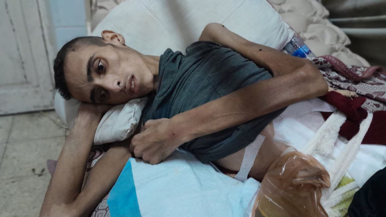 أصيب برصاصة متفجرة.. دغمش يصارع الموت على أسرة العلاج